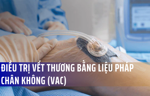 Điều trị vết thương bằng liệu pháp chân không (VAC)